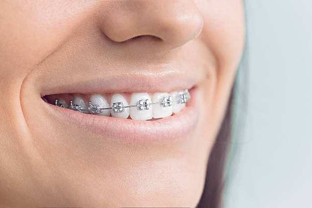 Best Veneers and Lumineers  in Leesburg, OH